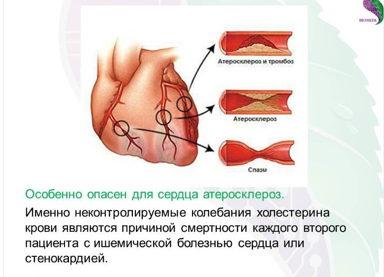 Тромба сердце причины. Риск развития атеросклероза. Атеросклероз и липопротеины. Сколько тромбов в сердце человека. Повышается.